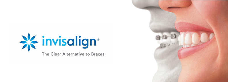 invisalign-clinica-lazaro