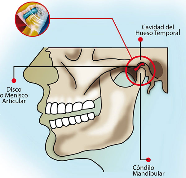 Mandíbula e Articulação Temporomandibular