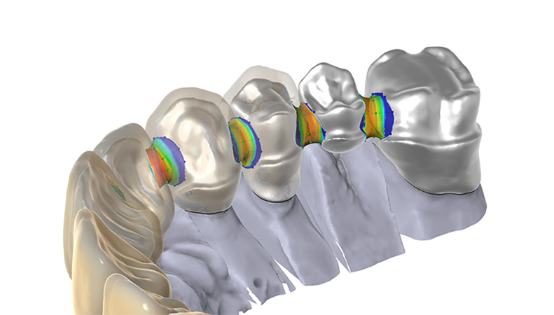 Technology CAD/CAM